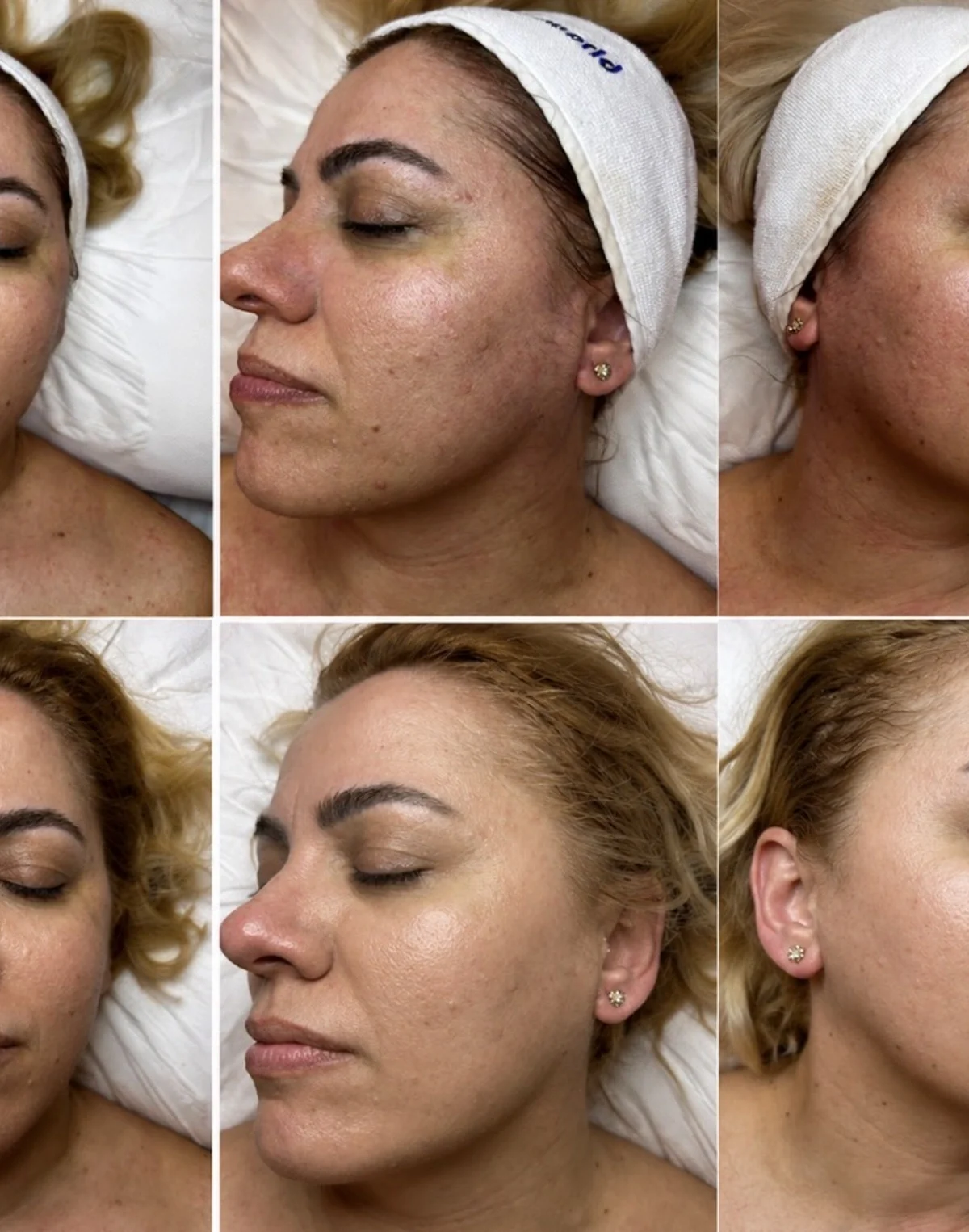 Skincare